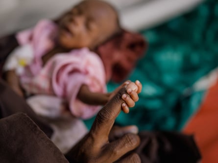 A malnourished three-month-old baby in Kismayo hospital’s intensive-care ward in September.Photograph: Hugh Kinsella Cunningham