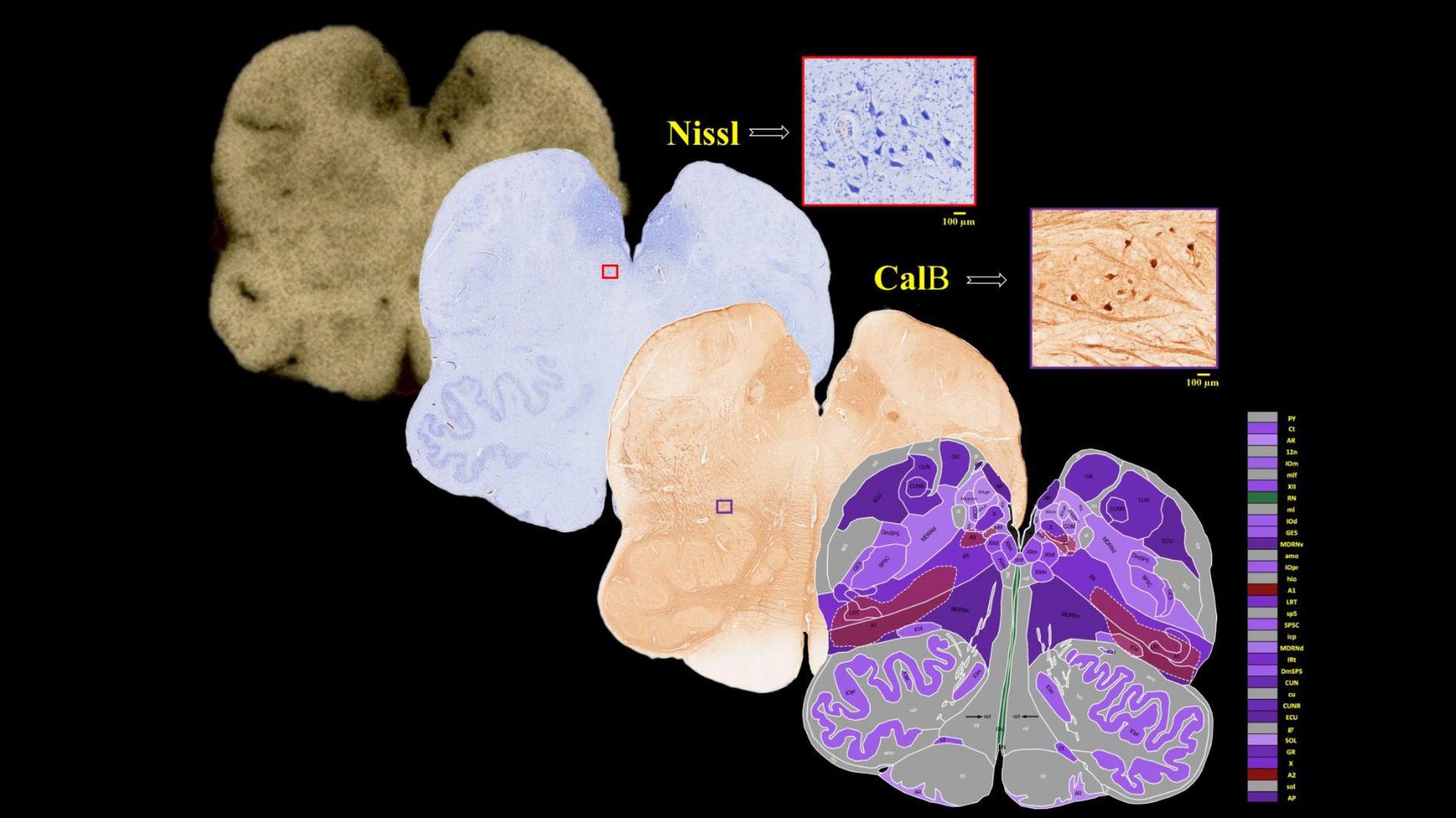 Image caption,Brainstem atlas sections - though only a sliver of the brain, the brainstem keeps us alive