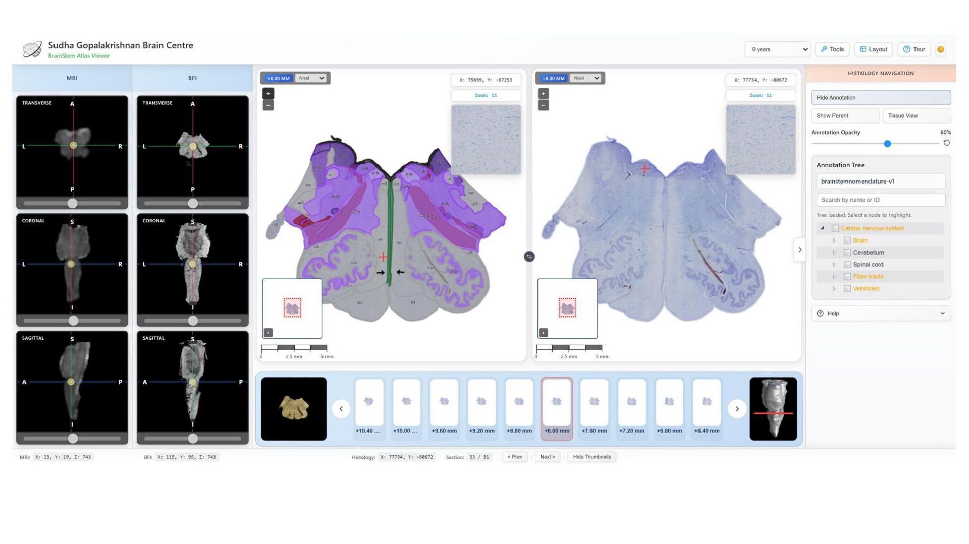Image caption,An online viewer enables seamless navigation from MRI scans of the whole brain to features at the cellular level