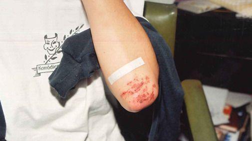 Image caption,Some of the photos showed injuries sustained by Joanne Lees during the attack