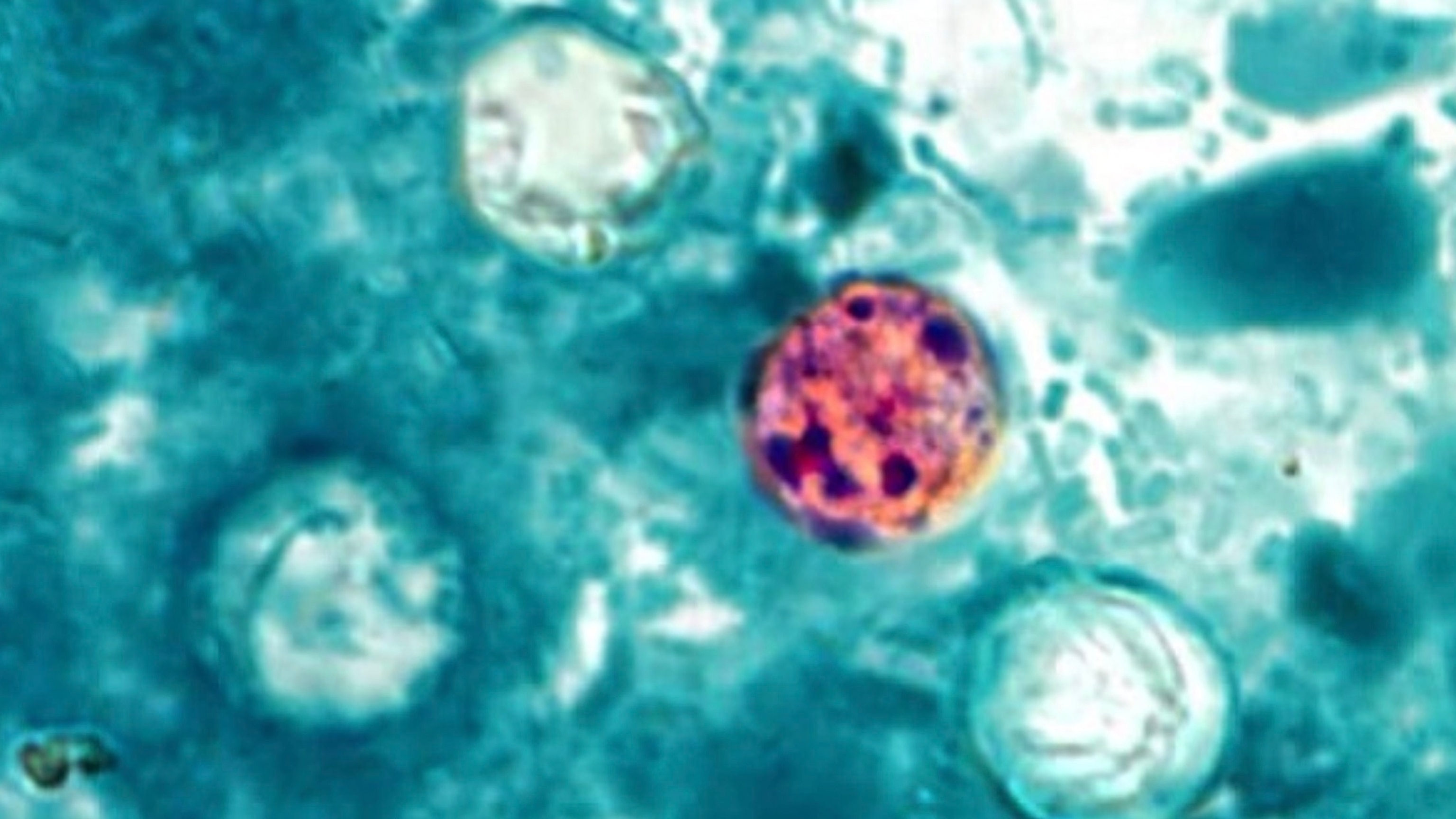 Cyclospora cayetanensis is a unicellular parasite that causes an intestinal infection called cyclosporiasis.CDC