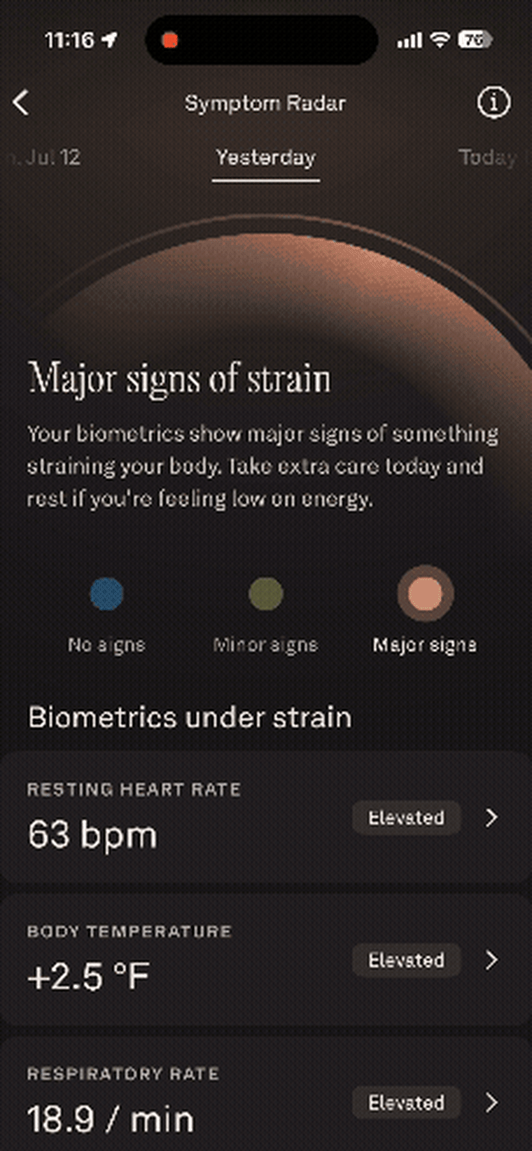 Symptom radar tracks key vitals that can help point to signs that you might be sick and need time to recover.Oura