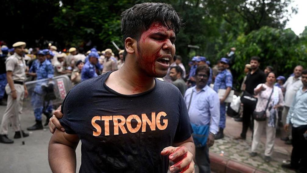 Image caption,Dozens of protesters were injured on Monday