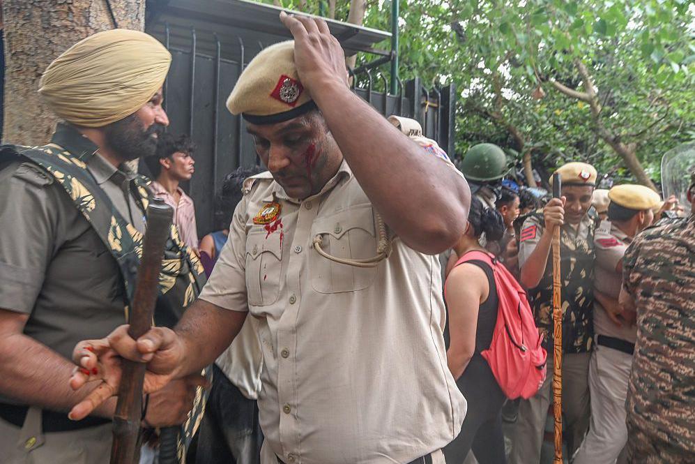 Image caption,Police said 118 of their personnel were also injured