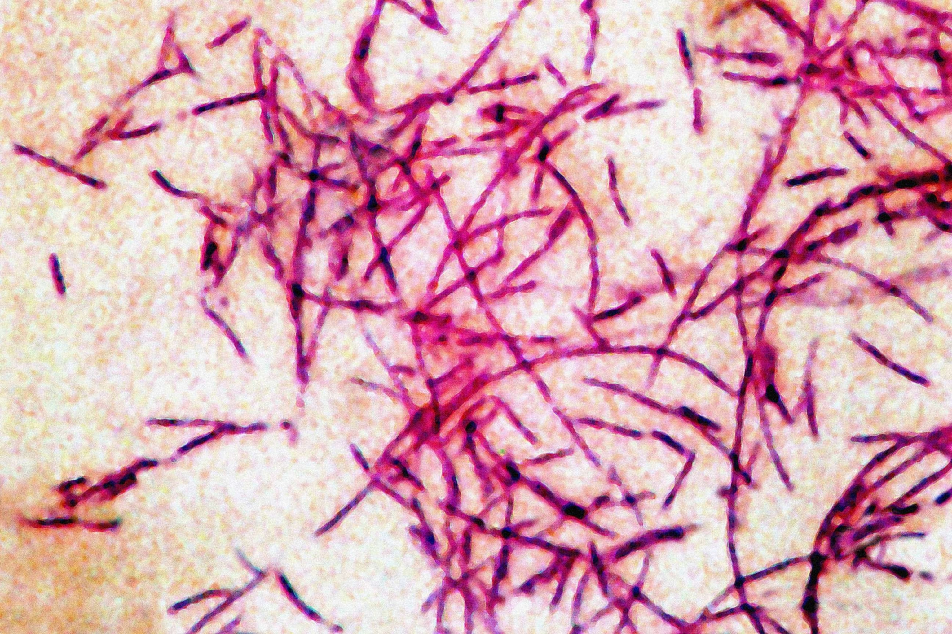 Legionnaire's Disease bacterium is seen in this stock photo.Bsip/uig/Getty Images/Universal Images Gr