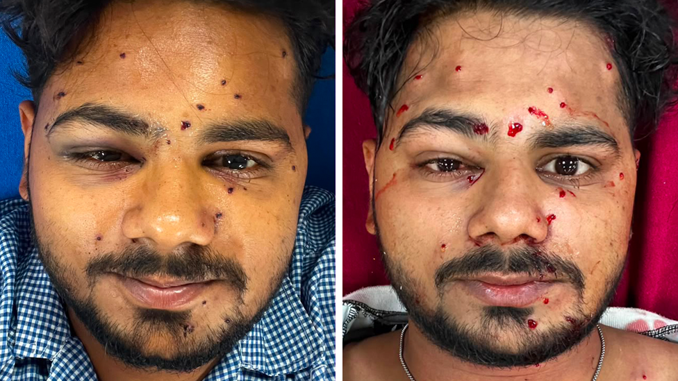 Image caption,Shaikh Irshad Mansoori said scans showed he had more than 40 pellets in his body