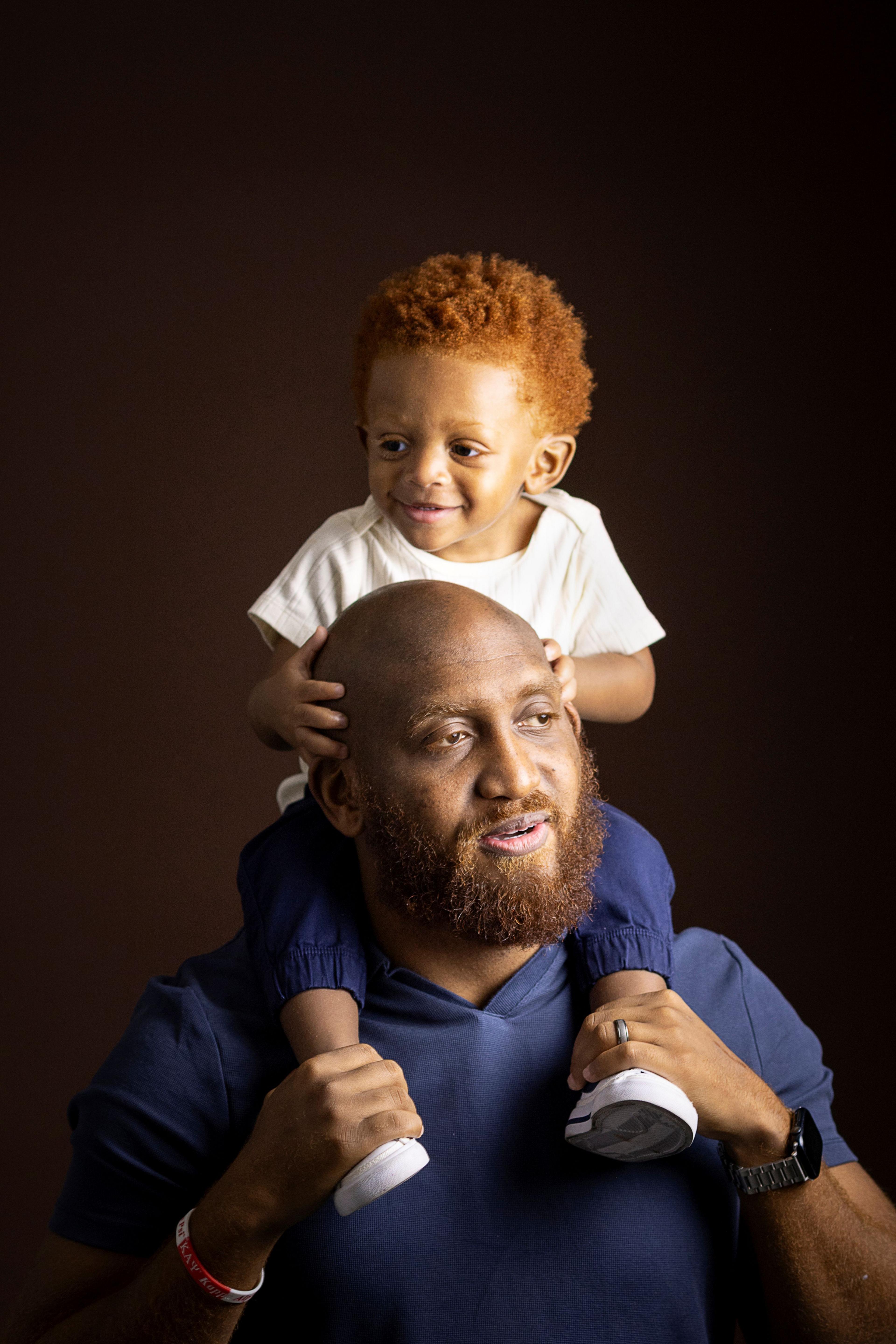 Image caption,Henry Davis says he had red hair like his son when he was younger