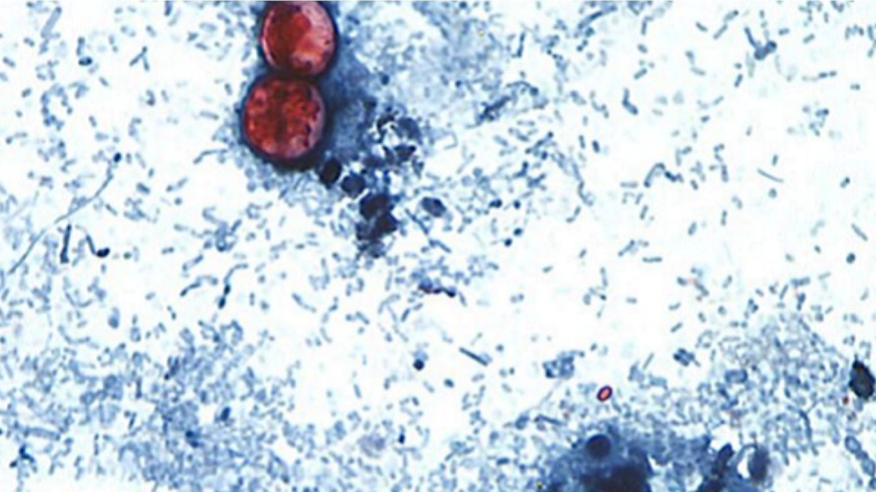 Cyclospora cayetanensis is a unicellular parasite that causes an intestinal infection called cyclosporiasis.CDC