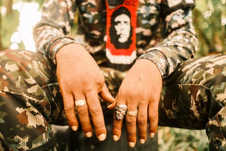 The hands of a member of an ELN member who lost a finger after being bitten by a snake while living in the jungle.Photograph: Santiago Mesa/The Guardian