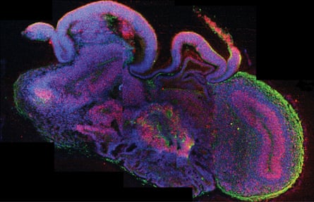 An image from the Institute of Molecular Biotechnology in Vienna depicts a cross-section of an organoid showing different brain regions, with all cells in blue, neural stem cells in red, and neurons in green.Photograph: Madeline A Lancaster/PA