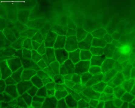 The authors compared the cuticle structure of modern leaves (pictured above under epifluorescence microscopy) with fossil leaf cuticles to create a model for canopy cover. Scale bar is 50 microns (0.05 mm).Photograph: Dr Regan Dunn
