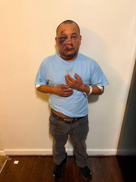 José Mejía Hernández recalled being hit by some kind of stun gun after being chased by ICE agents.Photograph: Courtesy of Margaret Hellerstein