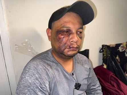 Mejía Hernández’s lawyer said it seemed agents had used violent tactics without justification.Photograph: Courtesy of Margaret Hellerstein