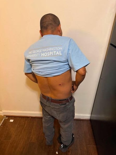 Photos of Mejía Hernández’s injurieshave spread widely on social media.Photograph: Courtesy of Margaret Hellerstein