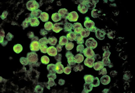 Naegleria fowleriinfections are extremely rare.Photograph: CDC/Reuters
