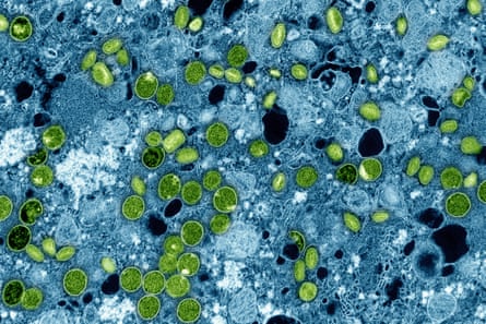 A colourised electron microscope image shows Mpox virus particles, represented in green, found within infected cultured cells, represented in blue. The virus particles are in various stages of maturity, which accounts for their differences in shape.Photograph: AP