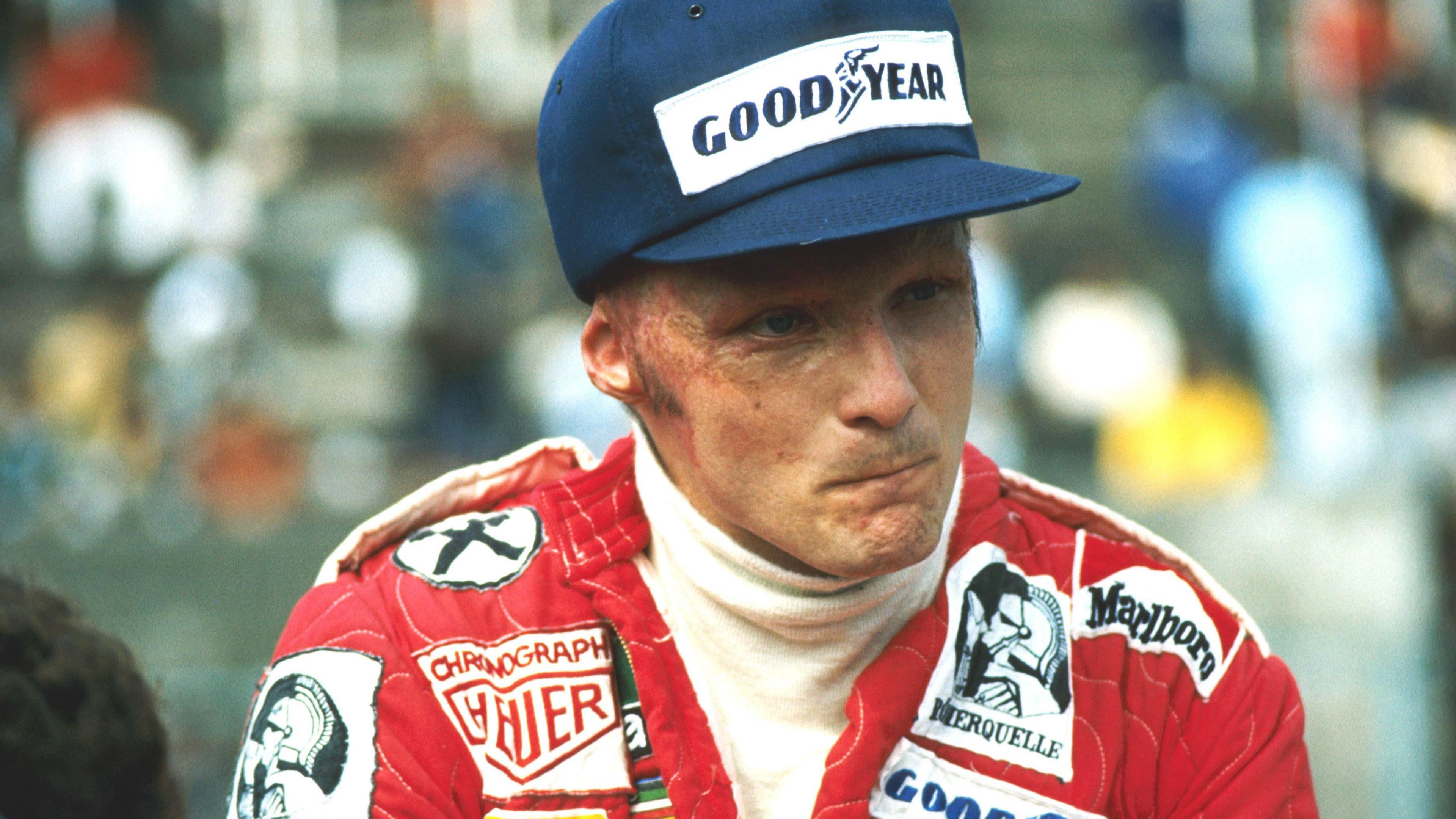 Image caption,Niki Lauda shows the scars of his near-fatal accident at the 1976 German Grand Prix at the Nurburging. The Austrian Ferrari driver returned to action just six weeks later at Monza, in significant pain, to continue his title battle with McLaren's James Hunt. Lauda finished fourth in Italy to extend his lead over the British driver but Hunt ultimately prevailed by a single point at the end of the season.
